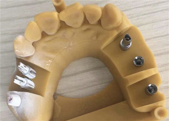 Крона 3D цифров Biocompatibility PFM зубоврачебная печатая временные кроны
