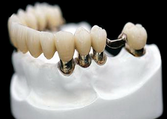 Коррозионная устойчивость Denture приложения точности CR MK1 CO