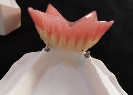 Высокий Denture CAD-CAM приложения точности Biocompatibility имплантирует