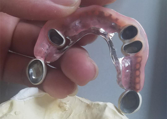 Гибкий прочный Denture приложения точности коррозионностойкий