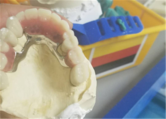 Гибкий прочный Denture приложения точности коррозионностойкий