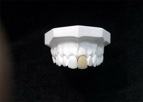 Материал хорошей кроны фарфора Biocompatibility зубоврачебной высокотехнологичный биологический