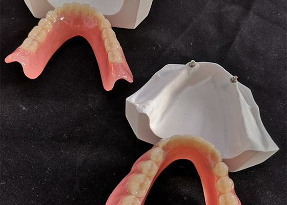Удобный зубной имплантат Overdenture CAD CAM легкое поддерживает