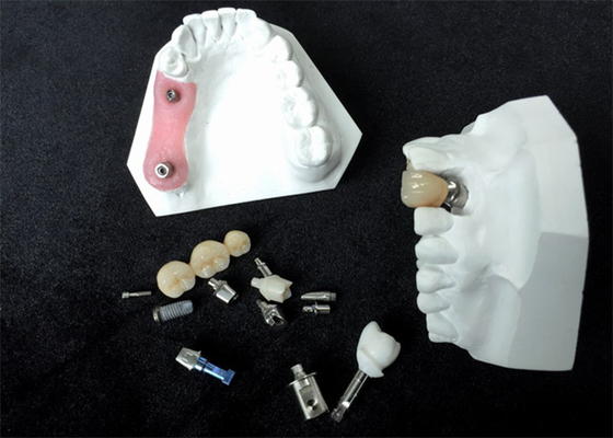 Denture приложения Адвокатуры стабильности изготовленных на заказ локаторов зубного имплантата высокий