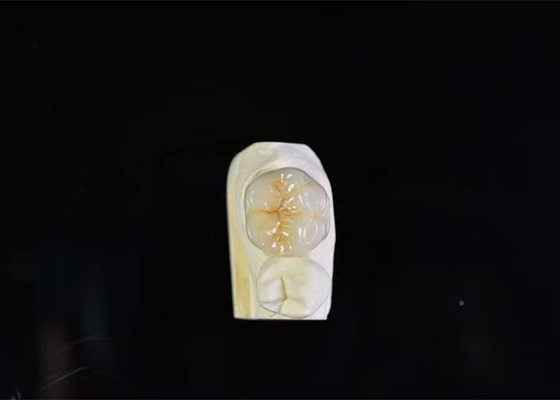 Сверхпрочная порцелановая зубная корона высокая биологическая совместимость