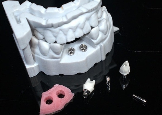 3D-модель Циркониевая корона