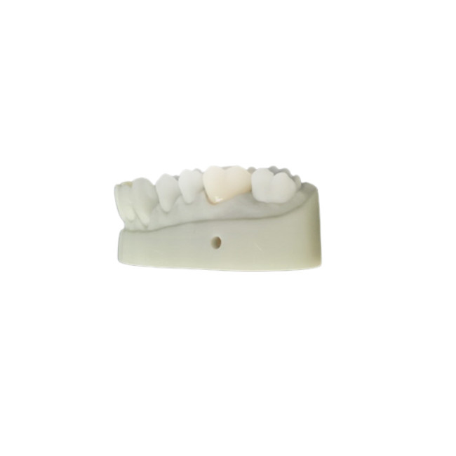 OEM 3D напечатал зубоврачебный дизайн CAD CAM моделей для лаборатории Denture