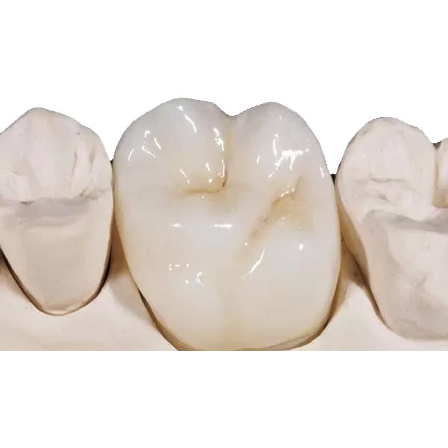 White Porcelain Zirconia Dental Crown High Density Unobstructed