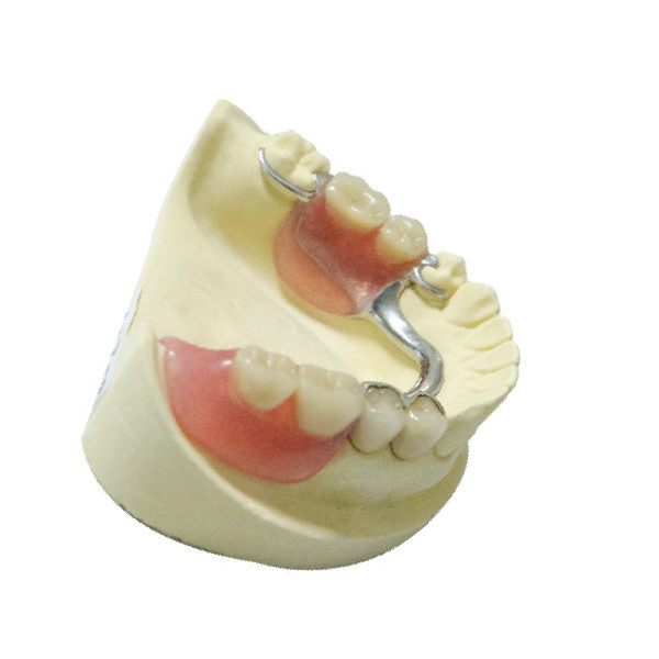 Продукты лаборатории стального съемного частично восстановления Denture Dentures зубоврачебные