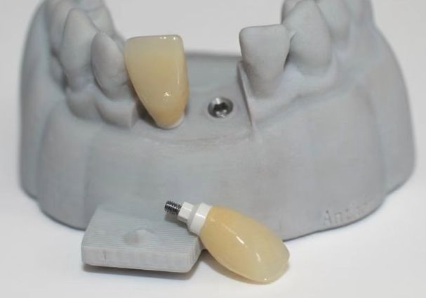 CAD PEEK специальный фундамент